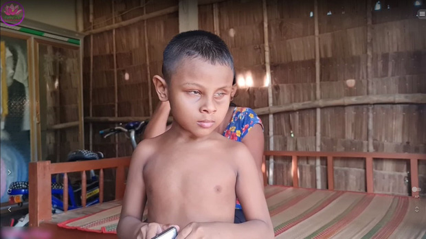 Cậu bé mù kỳ lạ ở Trà Vinh: Không ăn cơm, chỉ gặm gỗ, đất đá, 6 tuổi chưa biết nói - Hình 7