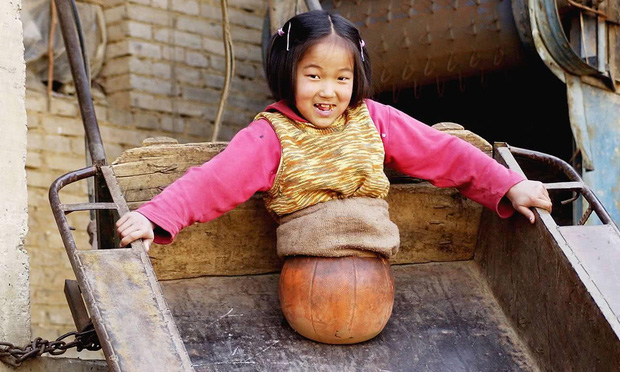 “Cô bé bóng rổ” mất nửa người vẫn lạc quan khiến thế giới cảm phục 15 năm trước: Kinh ngạc với cuộc sống thay đổi hoàn toàn ở hiện tại - Ảnh 3.