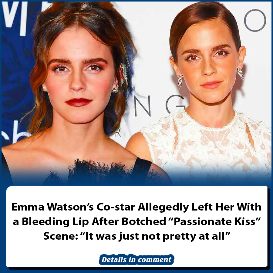 Emma Watson’s Co-star Allegedly Left Her With A Bleeding Lip After 