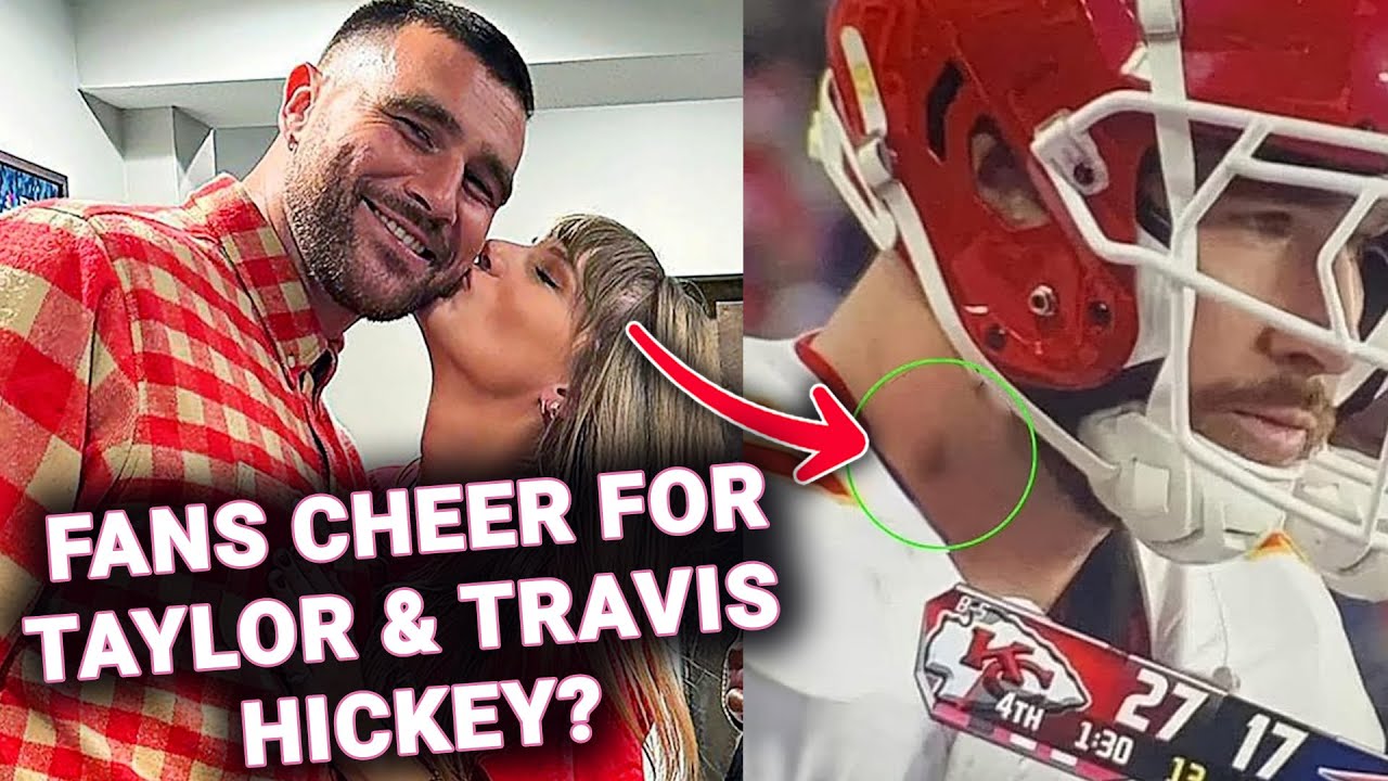 (X) Taylor Swift Fans Go Wild Thinking They Saw A ‘Hickey’ On Travis ...