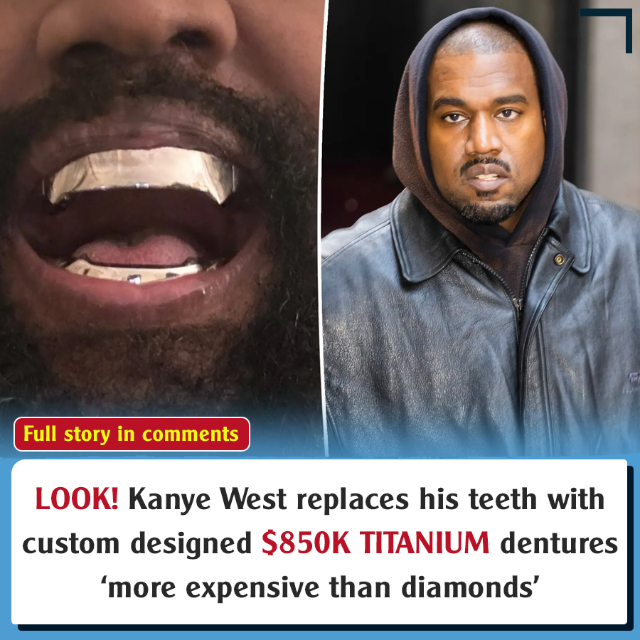 Kanye West replaces his teeth with custom designed 850k titanium