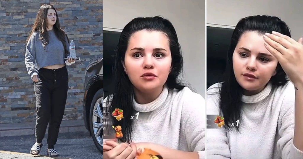 Selena Gomez Opens Up About Gaining Weight Due to Lupus Medication