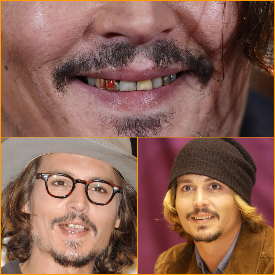 Unraveling the Mystery Behind Johnny Depp’s Teeth News