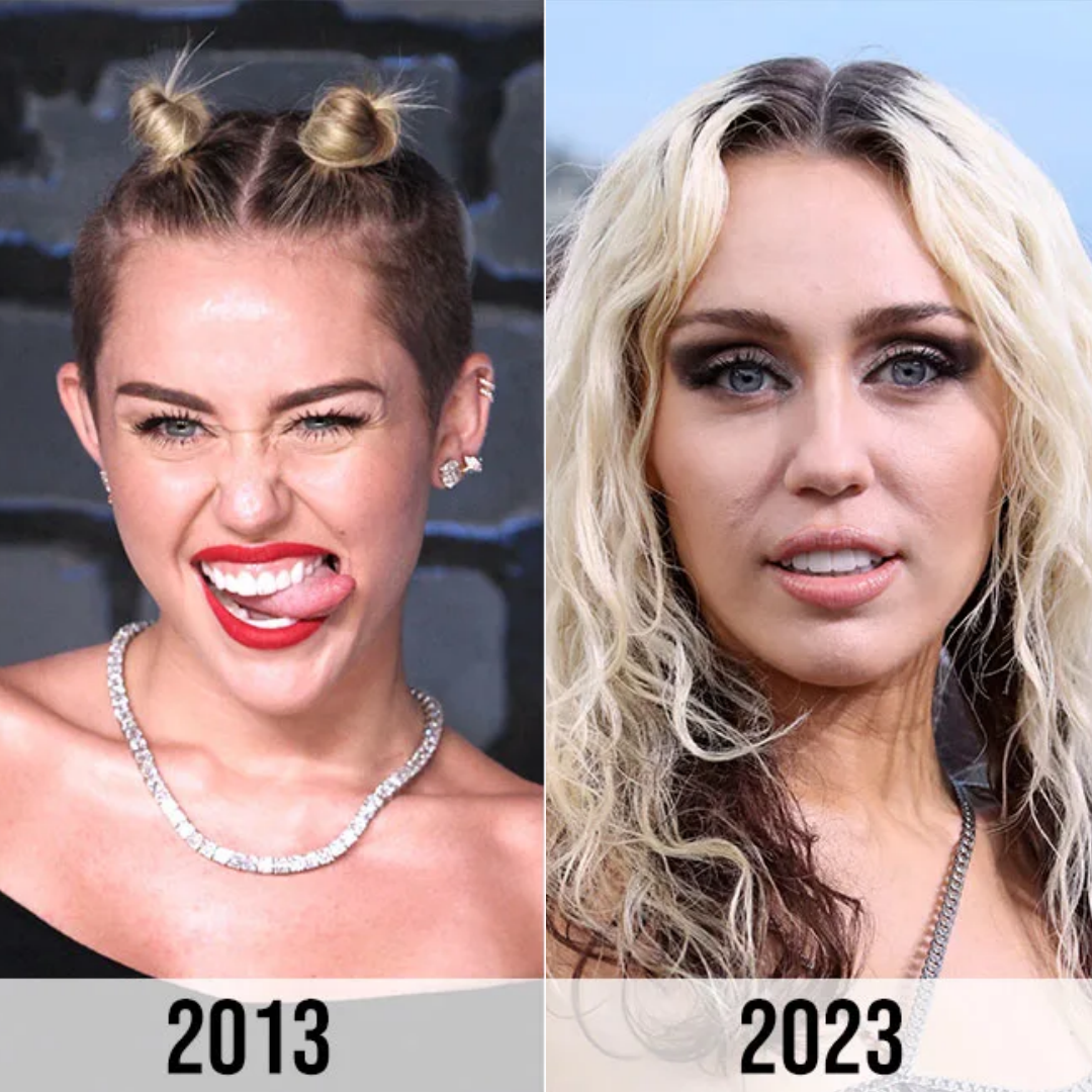 X Miley Cyrus’ Fans Speculate That She Got ‘plastic Surgery’ After Seeing Before And After