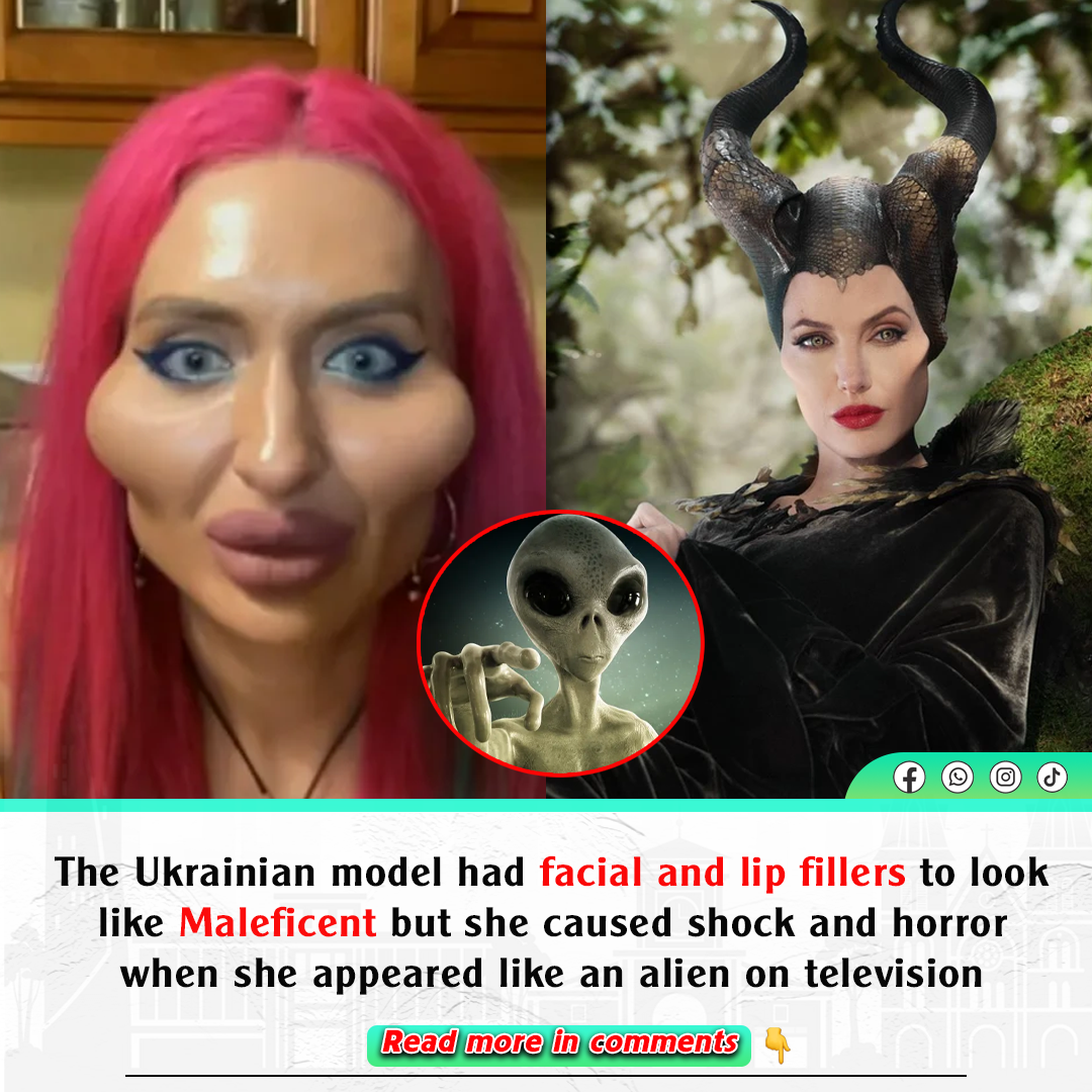 The Ukrainian model had facial and lip fillers to look like Maleficent ...