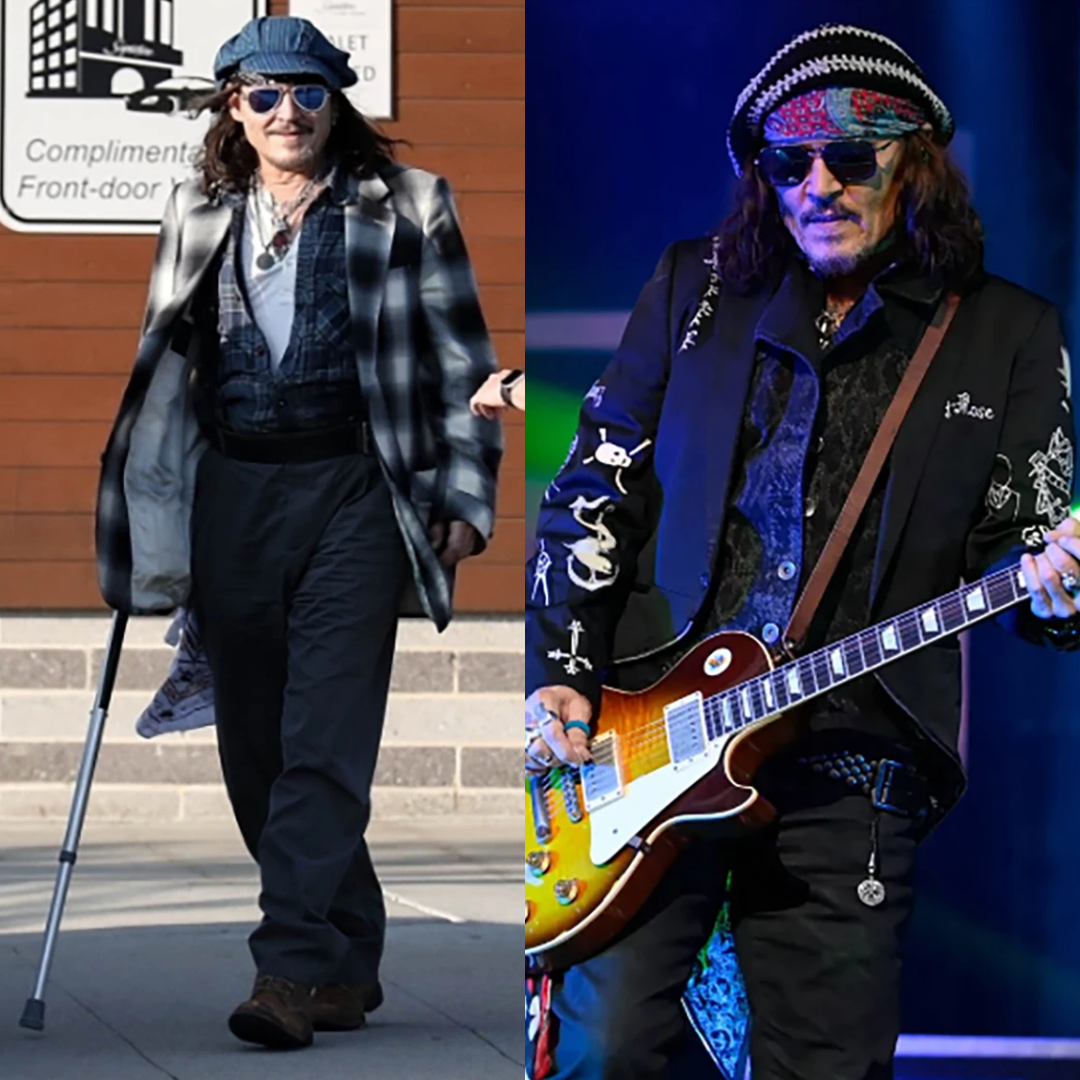 Johnny Depp had a leg injury but still performed - News